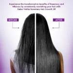 Dabur Vatika Naturals Rosemary Hair Growth Oil - 100ml